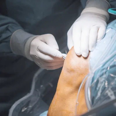 Dolor de rodilla en CDMX