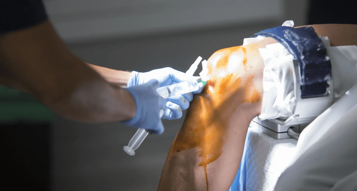 ¿Qué especialista trata la tendinitis?